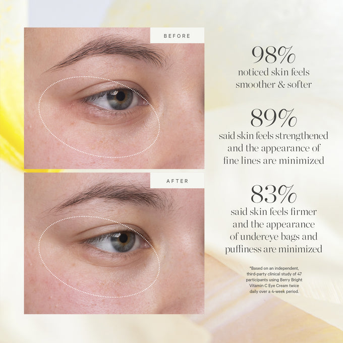 Kora Organics-Berry Bright Vitamin C Eye Cream-Skincare-4_PDP_ConsumerStudy-BerryBright_V1-The Detox Market | 