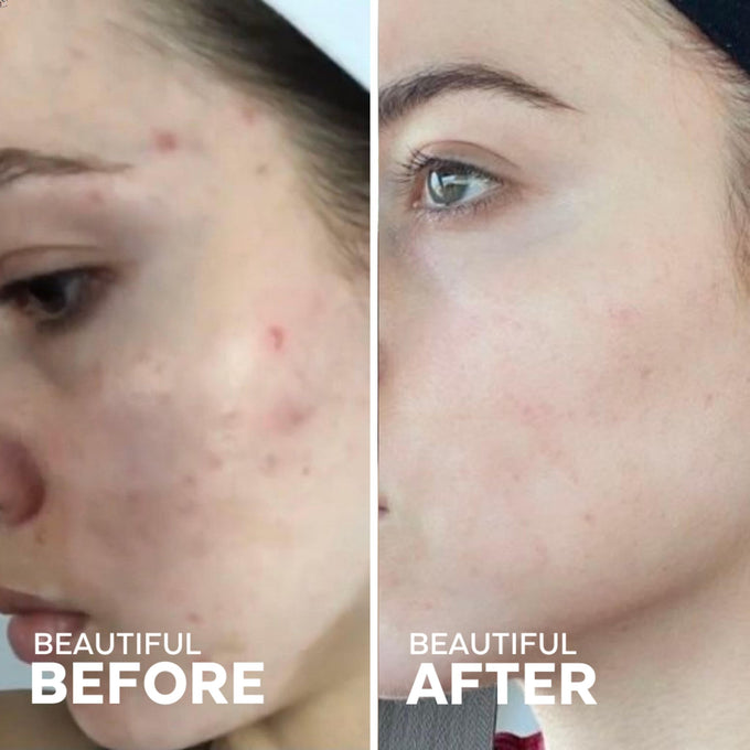 Three Ships-Dew Drops Mushroom Hyaluronic Acid + Vitamin C Serum-Skincare-628110639776_4-The Detox Market | 1 oz