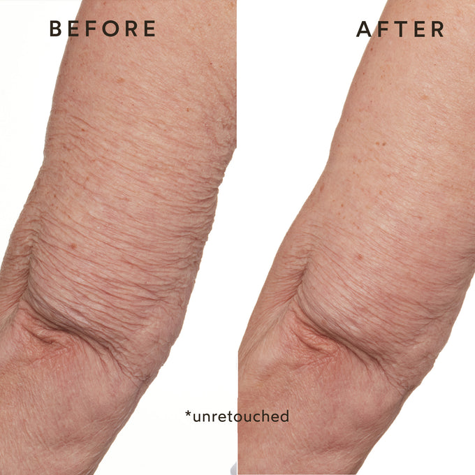 True Botanicals-Phyto-Retinol Anti-Aging Body Lotion-Body-B-W-D-PRBT-R-13-The Detox Market | 