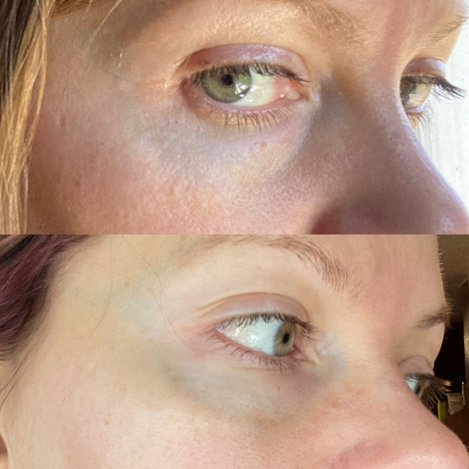True Botanicals-Deep Repair Eye Serum-Skincare-S-W-D-DRES-R_CindiBeforeandAfter1-The Detox Market | 