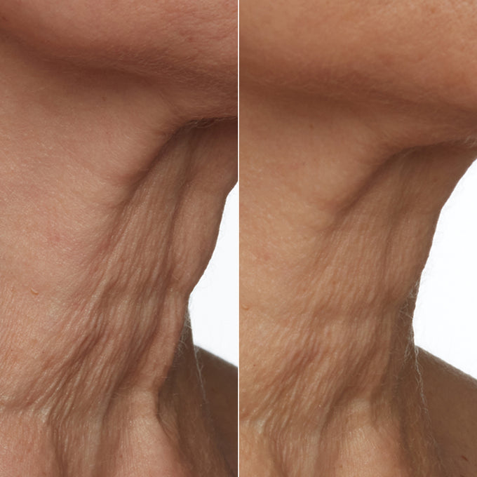 True Botanicals-SuperSEA Firming & Lifting Treatment-Skincare-S-W-D-FLT1-R-6-The Detox Market | 