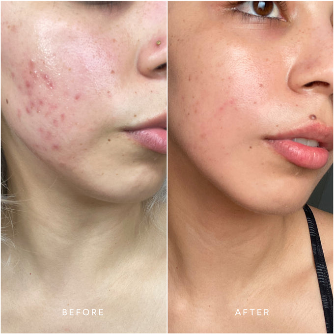 True Botanicals-CLEAR Pure Radiance Oil-Skincare-S-W-D-PRC1-R-4-The Detox Market | 