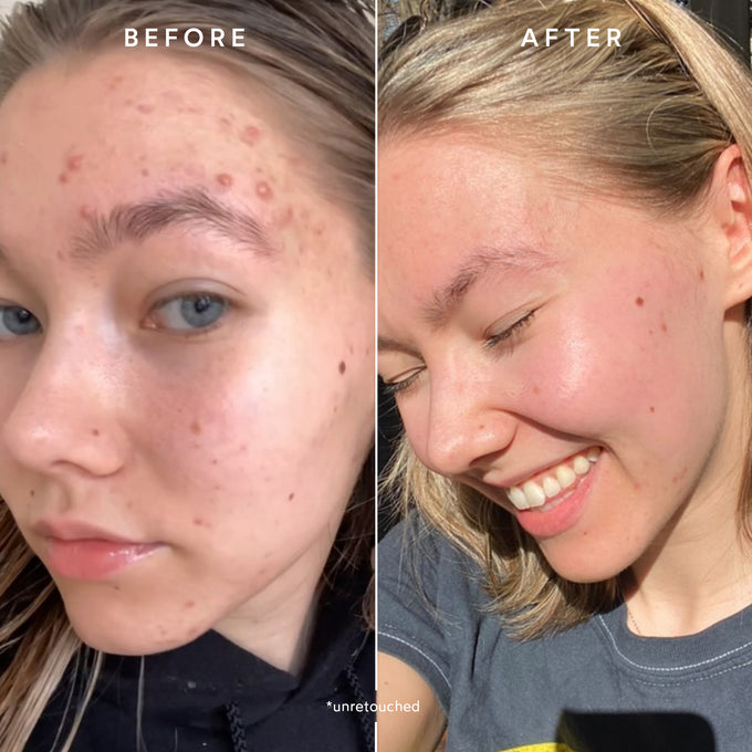 True Botanicals-CLEAR Pure Radiance Oil-Skincare-S-W-D-PRC1-R-6-The Detox Market | 