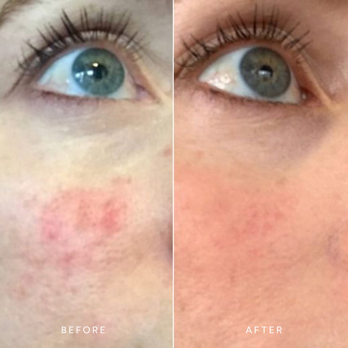 True Botanicals-CALM Pure Radiance Oil-Skincare-S-W-D-PRCM-R-5-The Detox Market | 