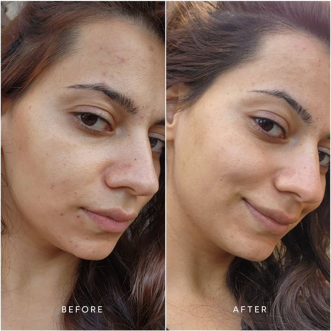 True Botanicals-RENEW Pure Radiance Oil-Skincare-S-W-D-PRR1-R-5-The Detox Market | 