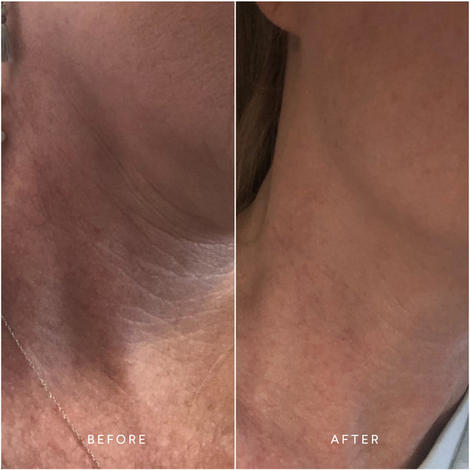 True Botanicals-RENEW Pure Radiance Oil-Skincare-S-W-D-PRR1-R-6-The Detox Market | 