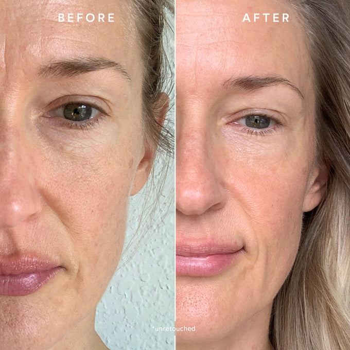 True Botanicals-RENEW Pure Radiance Oil-Skincare-S-W-D-PRR1-R-7-The Detox Market | 