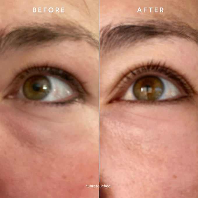 True Botanicals-RENEW Resurrection Radiance Eye Cream-Skincare-S-W-D-RREC-R-5-The Detox Market | 