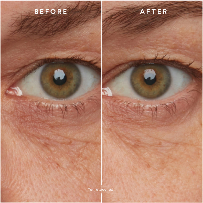 True Botanicals-RENEW Resurrection Radiance Eye Cream-Skincare-S-W-D-RREC-R-6-The Detox Market | 