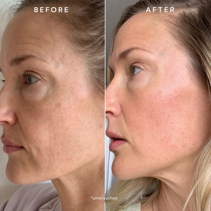 True Botanicals-RENEW Chebula Active Serum-Skincare-S-W-D-RSIS-R-5-The Detox Market | 