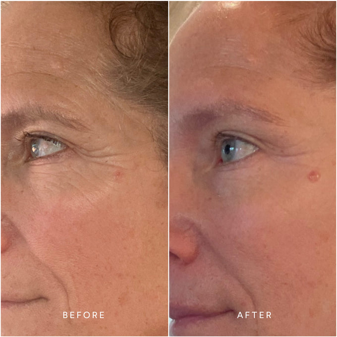 True Botanicals-RENEW Chebula Active Serum-Skincare-S-W-D-RSIS-R-6-The Detox Market | 