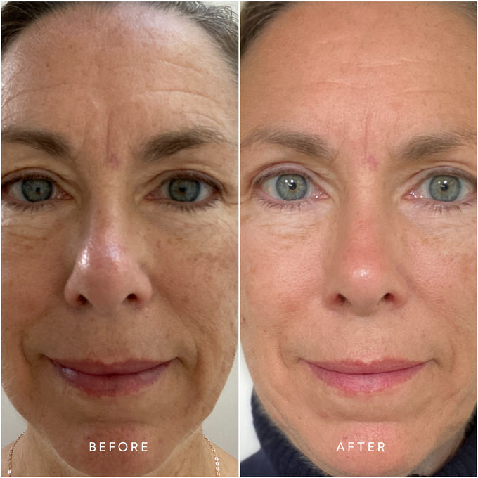 True Botanicals-RENEW Chebula Active Serum-Skincare-S-W-D-RSIS-R-7-The Detox Market | 