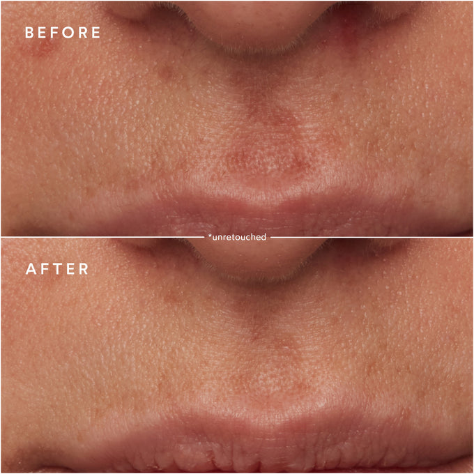 True Botanicals-Renew Microbiome Enzyme Essence-Skincare-S-W-D-SEE4-R-5-The Detox Market | 