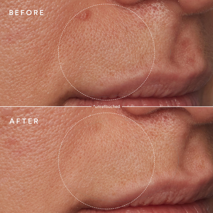 True Botanicals-Renew Microbiome Enzyme Essence-Skincare-S-W-D-SEE4-R-6-The Detox Market | 