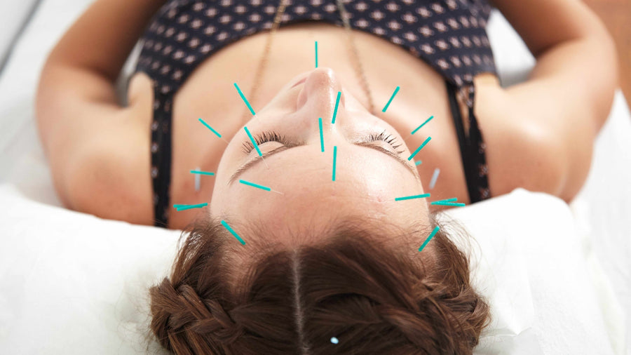 Acupuncture faciale : avantages et ce qu’elle peut faire pour vous