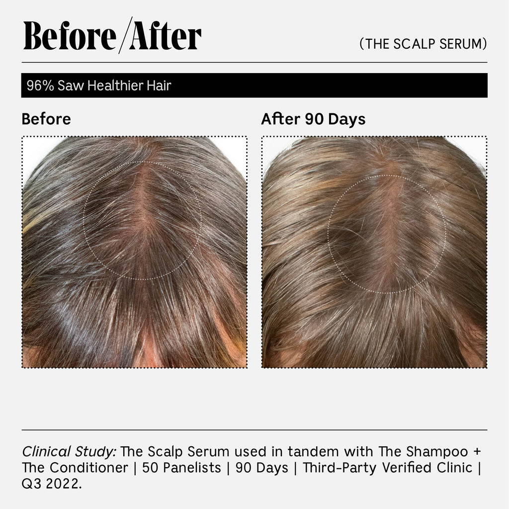 Nécessaire-The Scalp Serum-Hair-14_TheScalpSerum30ml-The Detox Market | 