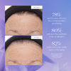 Kora Organics-Plant Stem Cell Retinol Alternative Serum-Skincare-4_PDP_ConsumerStudy-PSCRAS_V1-The Detox Market | 