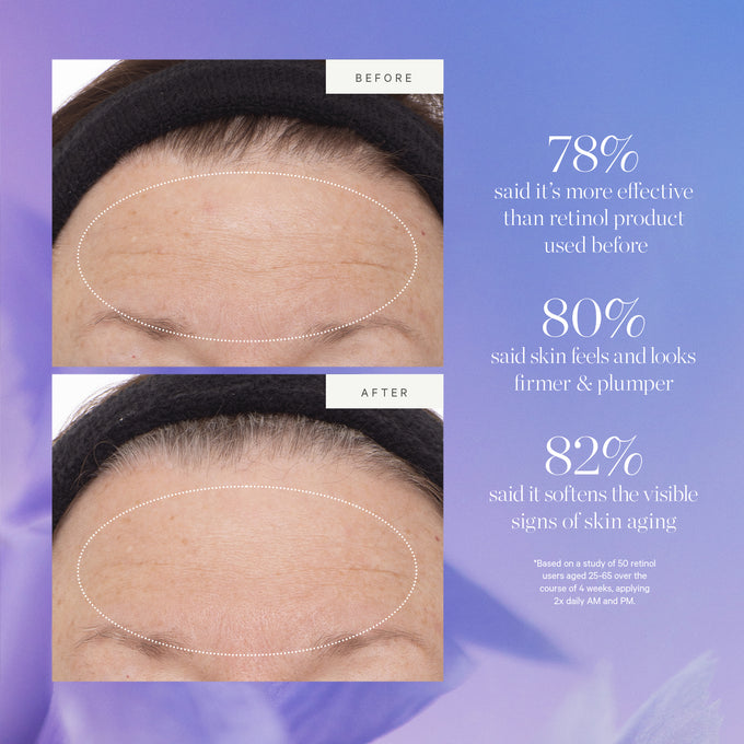 Kora Organics-Plant Stem Cell Retinol Alternative Serum-Skincare-4_PDP_ConsumerStudy-PSCRAS_V1-The Detox Market | 