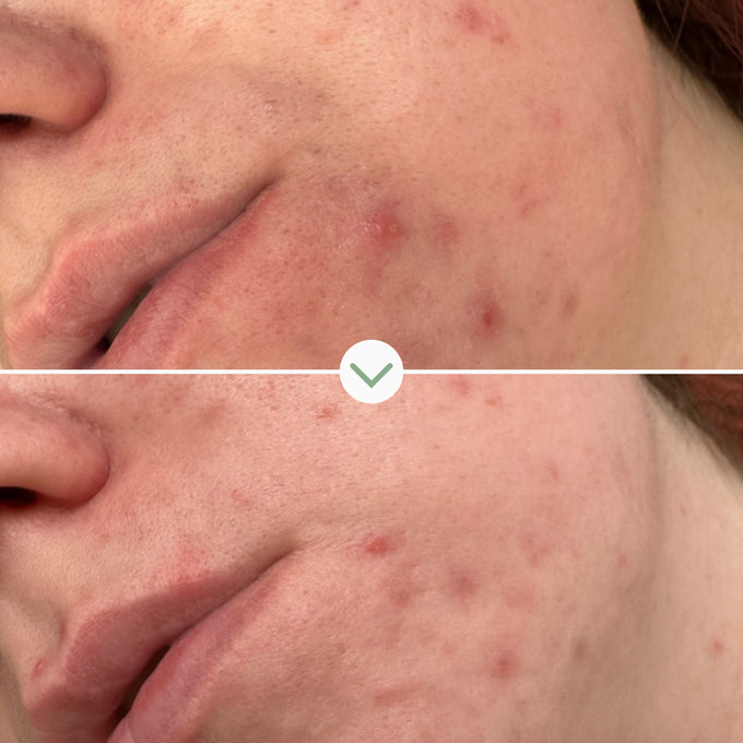 Pai Skincare-Phaze Rebalance Cleanser-Skincare-5060139729048_5-The Detox Market | 