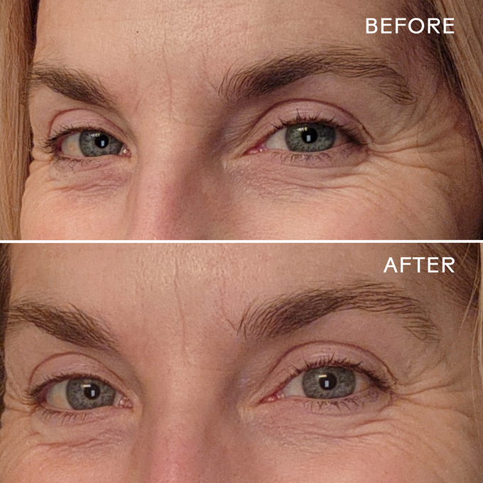 Three Ships-Eye Hero Bio-Retinol Smoothing Eye Cream-Skincare-628110639530-13_B_A2-The Detox Market | 