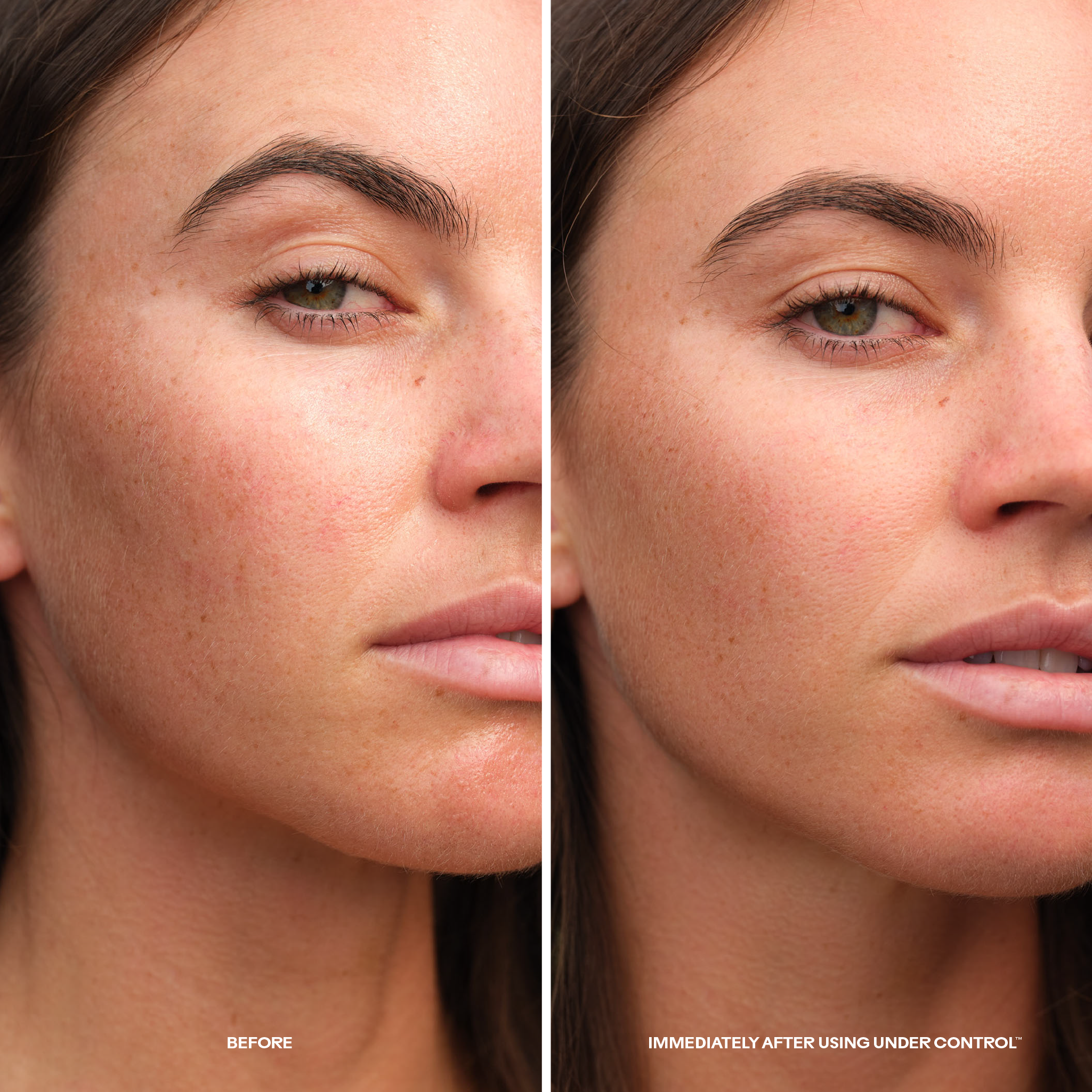 Three Ships-Under Control™ Mango + Beta-Glucan Mattifying Gel Cream-Skincare-990478500334-UnderControl_Mango_Beta-GlucanMattifyingGelCream_5_BeforeAfter-The Detox Market | 