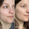 Three Ships-Take Five™ Hypochlorous Acid Balancing Body + Face Spray-Skincare-990478500341_9_Before_After-The Detox Market | 