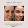 True Botanicals-CLEAR Repair Nightly Treatment-Skincare-BA1_ClearTreatment_2048x2048_c7182ce2-ad92-4947-ac64-5ed73fc1ae46-The Detox Market | 