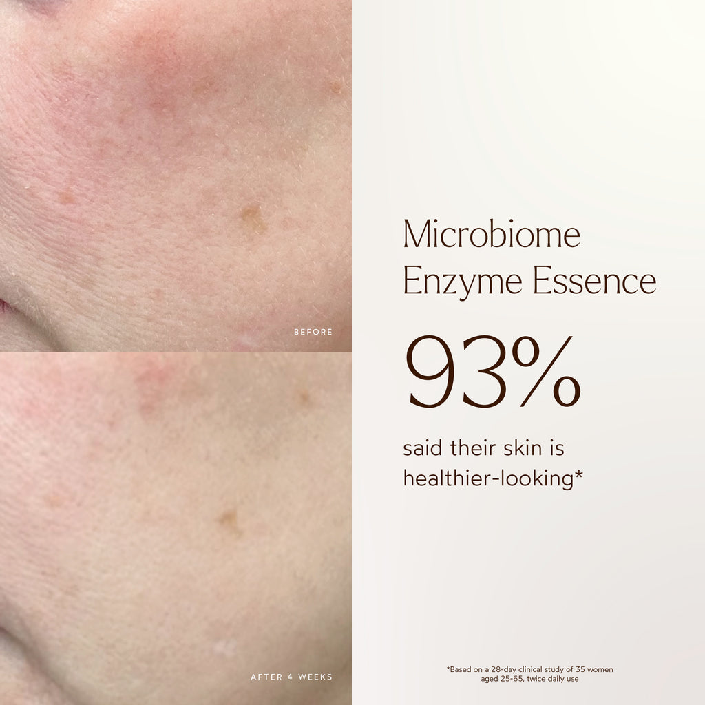 True Botanicals-Renew Microbiome Enzyme Essence-Skincare-BA1_Essence_2048x2048_0fbe18ff-a9bc-4b00-8a07-408f5ca8ba36-The Detox Market | 