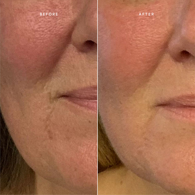 True Botanicals-RENEW Repair Nightly Treatment-Skincare-BA1_NightlyTreatment_2048x2048_afe4a585-0de4-433d-a878-95a5107e9ff6-The Detox Market | 