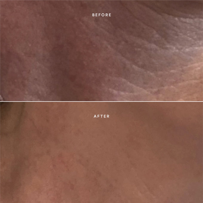 True Botanicals-RENEW Repair Nightly Treatment-Skincare-BA2_NightlyTreatment_2048x2048_5ea44b2b-b5d0-4e53-bdc6-248207ab467f-The Detox Market | 