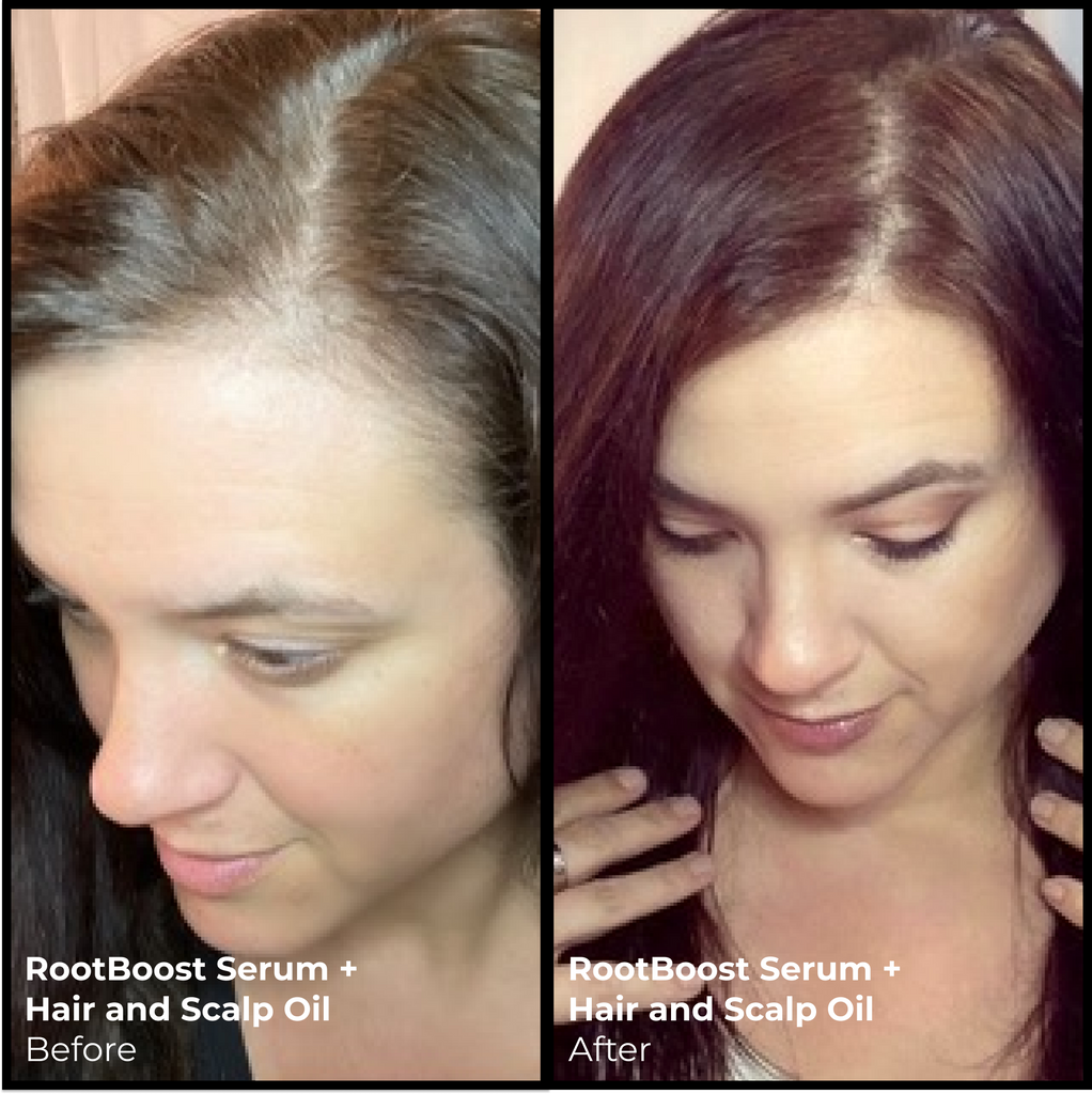 EVOLVh-Better Roots Scalp + Hair Oil-Hair-BRoilandserumSherBefore_After2-The Detox Market | 