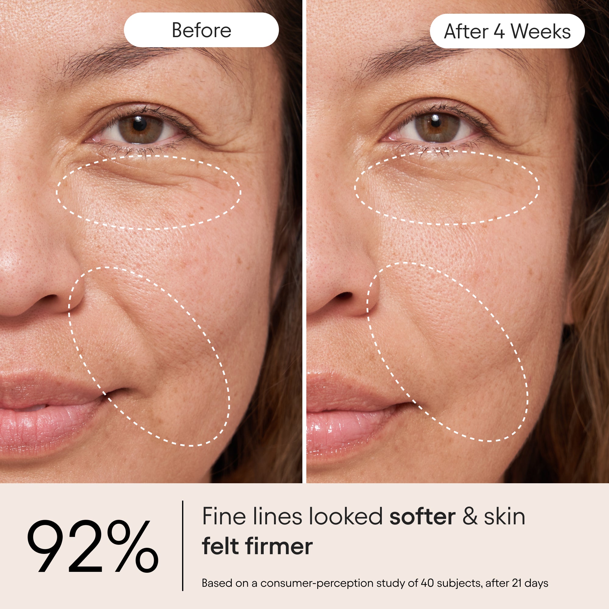 Barrier Repair Cream – The Detox Market - Canada