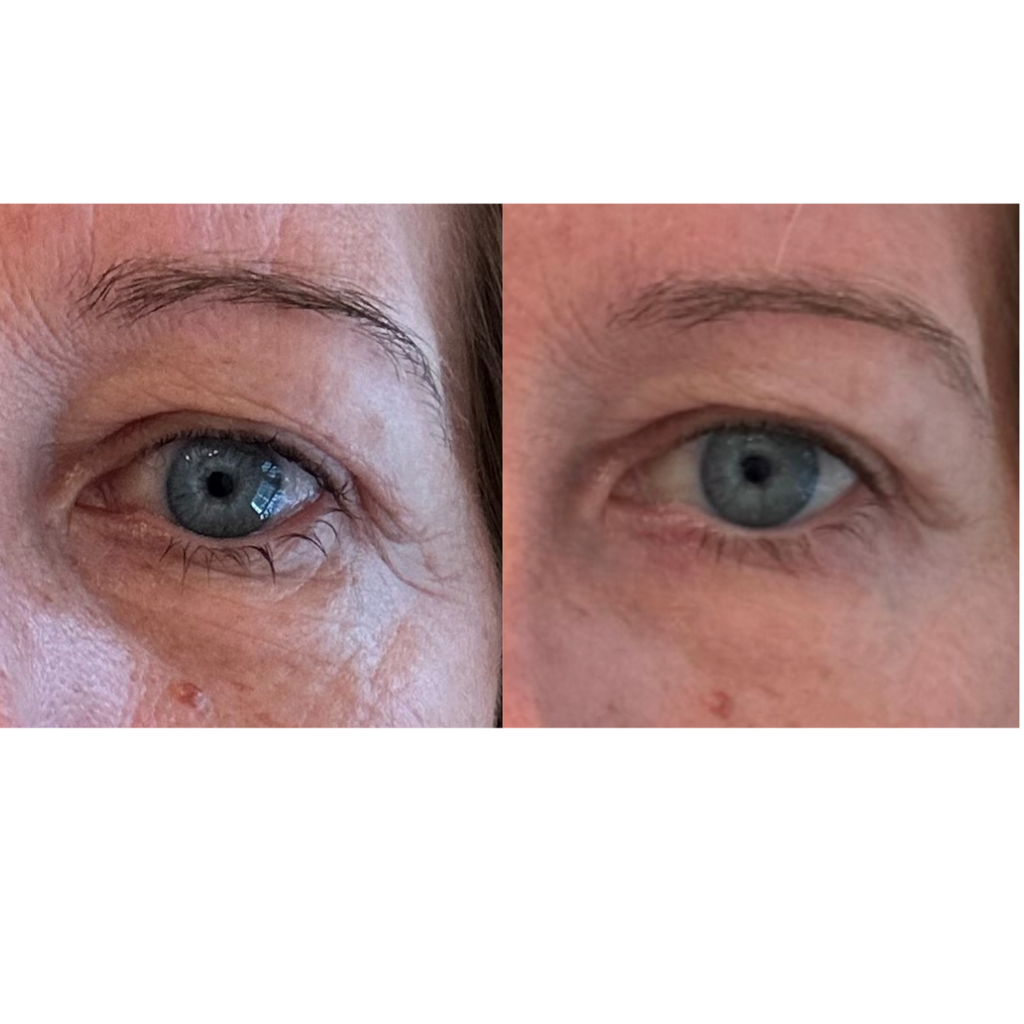 Maya Chia-The Advanced Eye Response Complex-Skincare-BeforeAfter2-The Detox Market | 