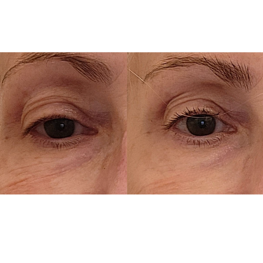 Maya Chia-The Advanced Eye Response Complex-Skincare-BeforeAfter3-The Detox Market | 