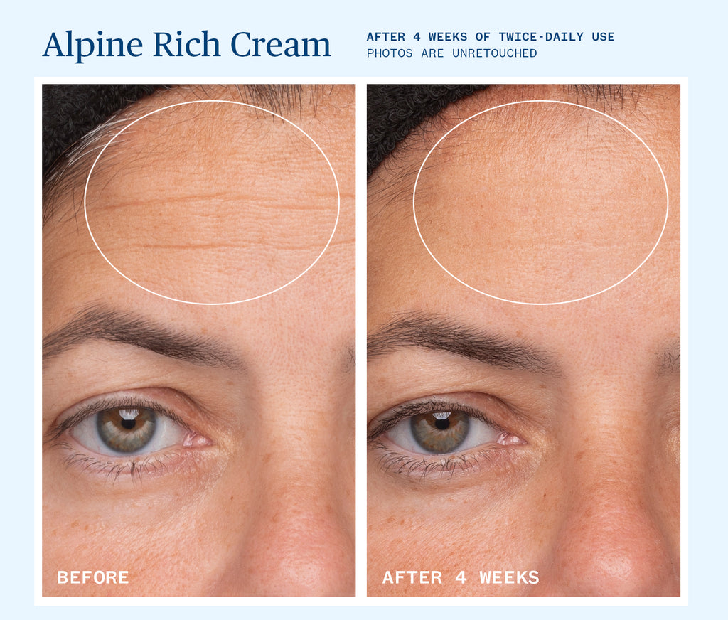 Ursa Major-Alpine Rich Cream-Skincare-BeforeAndAfter_PDP_RichCream_02-The Detox Market | 