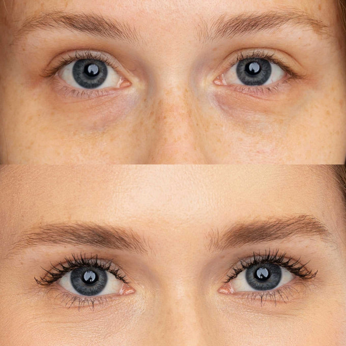 Correct + - Makeup - Fitglow Beauty - Corrector_Eyebright_BA_01_DTC - The Detox Market | Eyebright