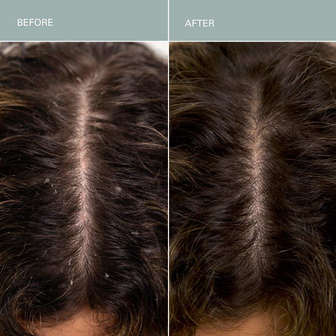 RŌZ-Salt Scalp Scrub Exfoliating Detox Shampoo-Hair-FGRZSCSCB0000_03-The Detox Market | 