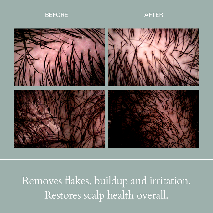 RŌZ-Salt Scalp Scrub Exfoliating Detox Shampoo-Hair-FGRZSCSCB0000_04-The Detox Market | 