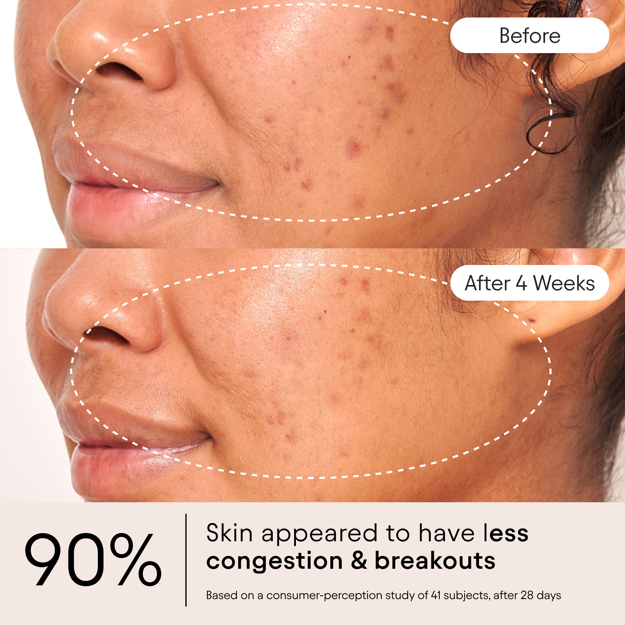 Alpyn Beauty-Clarifying Facial Oil With Retinol & Pink Algae-Skincare-FaceOil5-The Detox Market | 