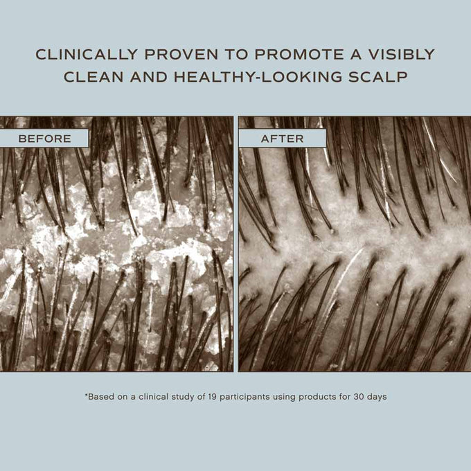 Innersense-Hair Renew Soothing Conditioner-Hair-HairRenewDuo_BeforeAndAfter_DetoxMarket_563420cb-d83e-451a-9032-56d2ff9e45b8-The Detox Market | 