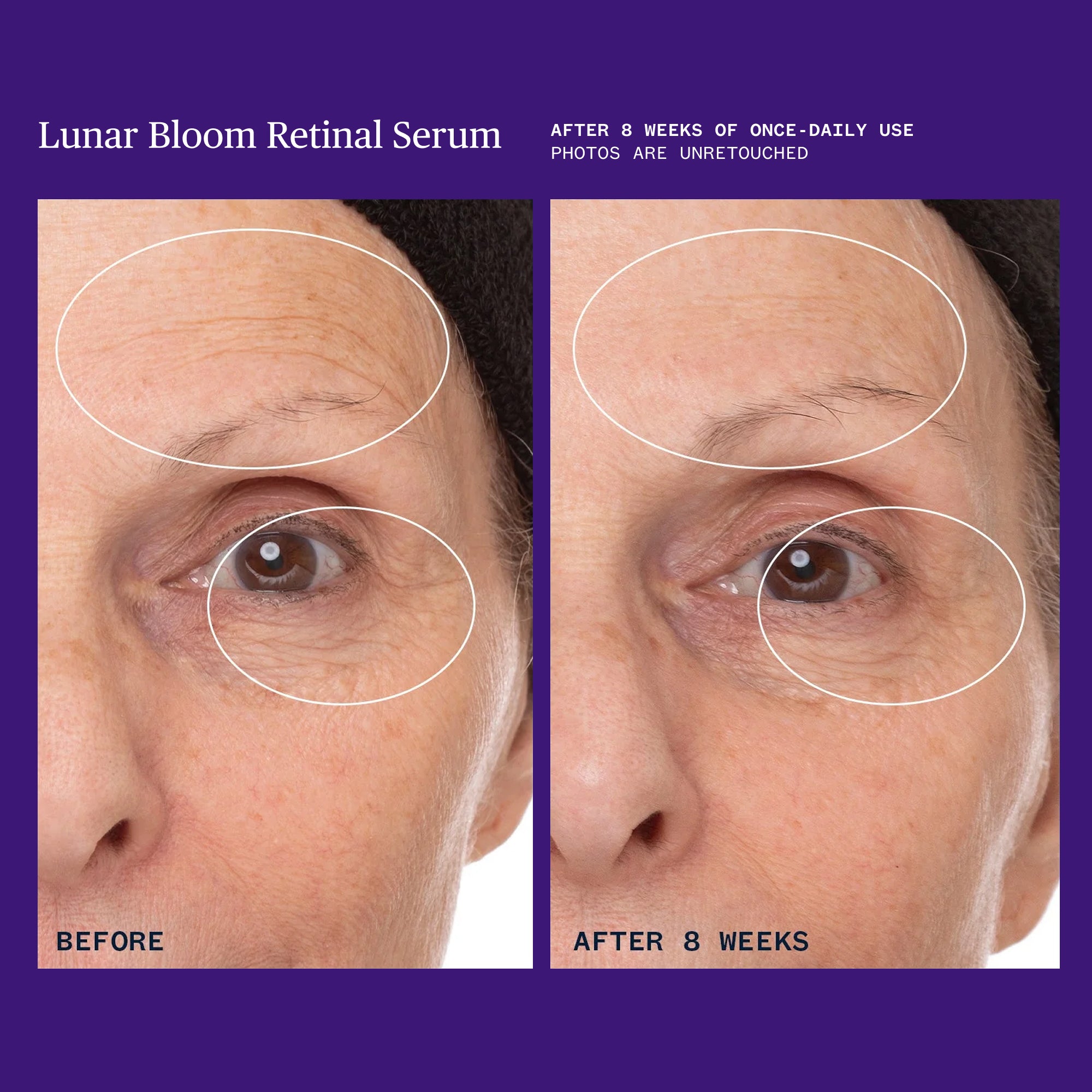 Ursa Major-Lunar Bloom Retinal Serum-Skincare-Lunar-Bloom-Retinal-Serum-09_9178e77d-9af2-41e3-9e21-cc4c37863590-The Detox Market | 