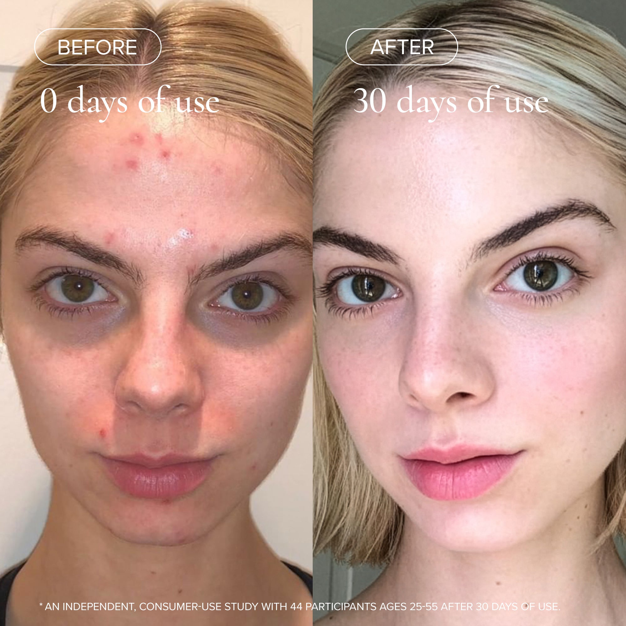 MARA-Evening Primrose + Green Tea Algae Retinol Face Oil-Skincare-MARA-ARO-30_18-The Detox Market | 