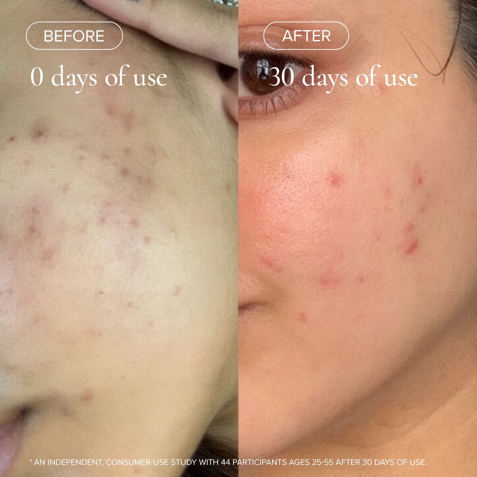 MARA-Evening Primrose + Green Tea Algae Retinol Face Oil-Skincare-MARA-ARO-30_19-The Detox Market | 