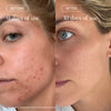 MARA-Flower Acid Algae Serum-Skincare-MARA-FAAS-30_4_49dedf81-cb04-46f7-a700-7c29e3185e5c-The Detox Market | 