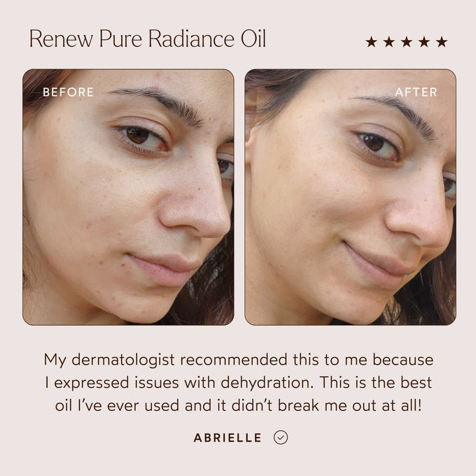 True Botanicals-3 Steps to Glowing Skin-Set-RetailResizeBefore_Afters4-05-The Detox Market | 