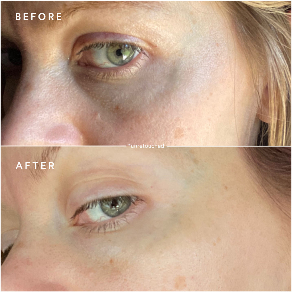 True Botanicals-Deep Repair Eye Serum-Skincare-S-W-D-DRES-R-6-The Detox Market | 