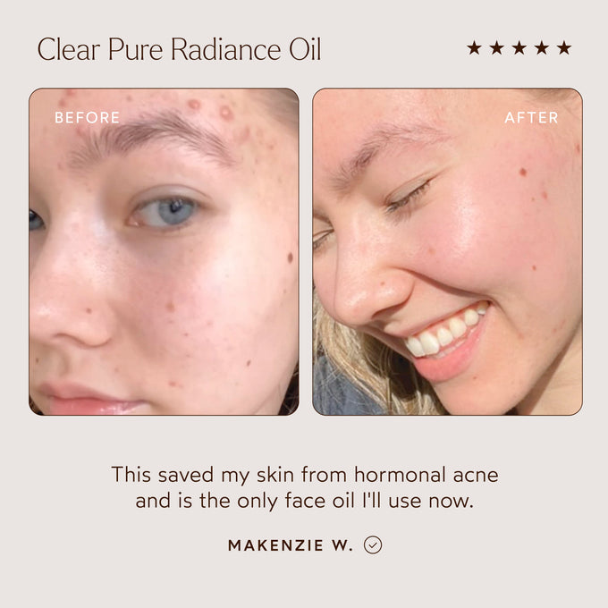 True Botanicals-CLEAR Pure Radiance Oil-Skincare-S-W-D-PRC1-R-4_72118aee-3f27-46d6-8cb7-55c32c0a4983-The Detox Market | 