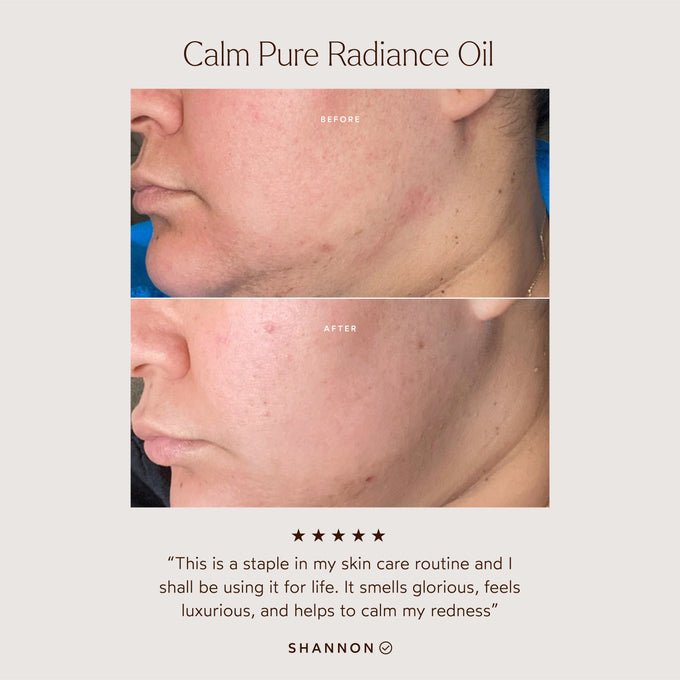 True Botanicals-CALM Pure Radiance Oil-Skincare-S-W-D-PRCM-R-3_81ec7a95-8395-484d-bdd0-1f888f467540-The Detox Market | 