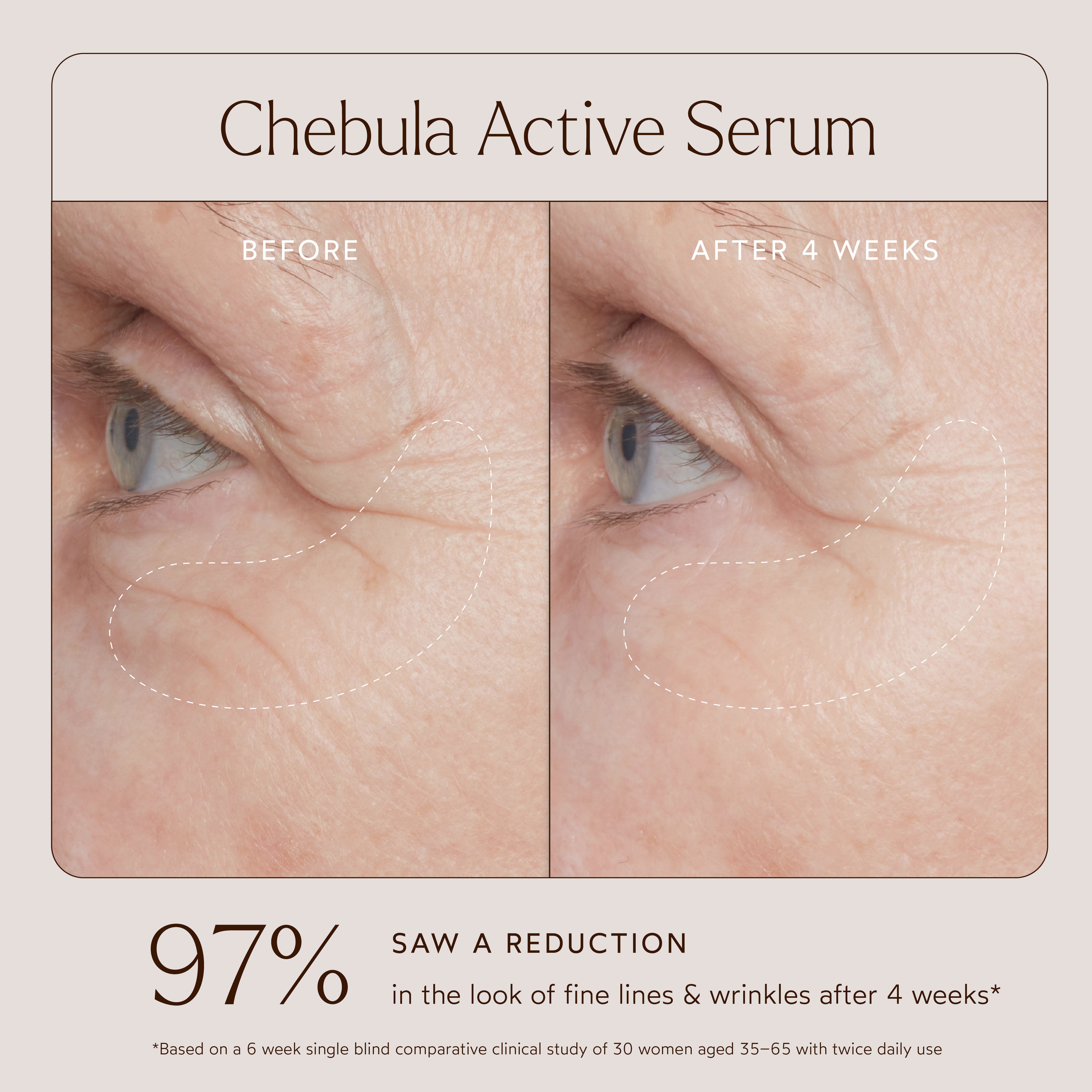 True Botanicals True Botanicals Chebula Active Serum Renew Immunity ...