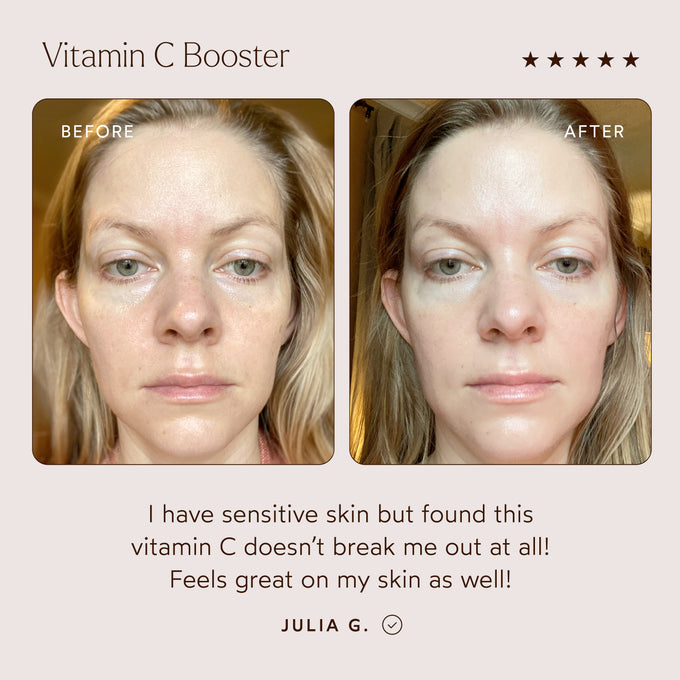 True Botanicals-Vitamin C Booster-Skincare-S-W-D-VTCB-R-3_ac1731b1-f1b0-4c0f-b580-bd2d02093f24-The Detox Market | 